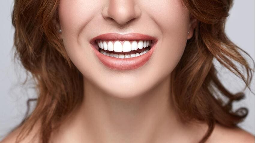 Sourire après un All-on-4