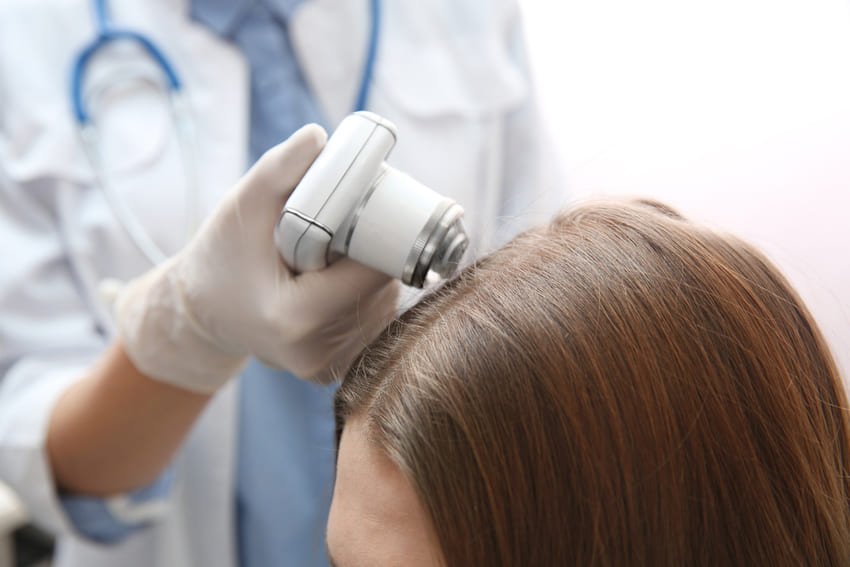 diagnostic capillaire chez la femme