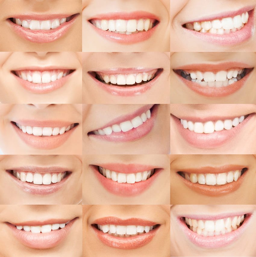 Florilège de sourire