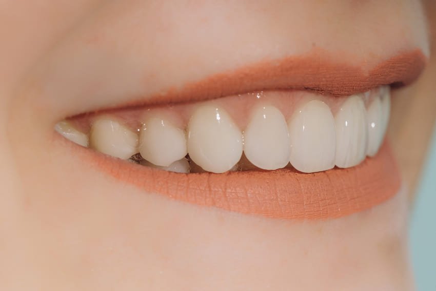Un sourire parfait